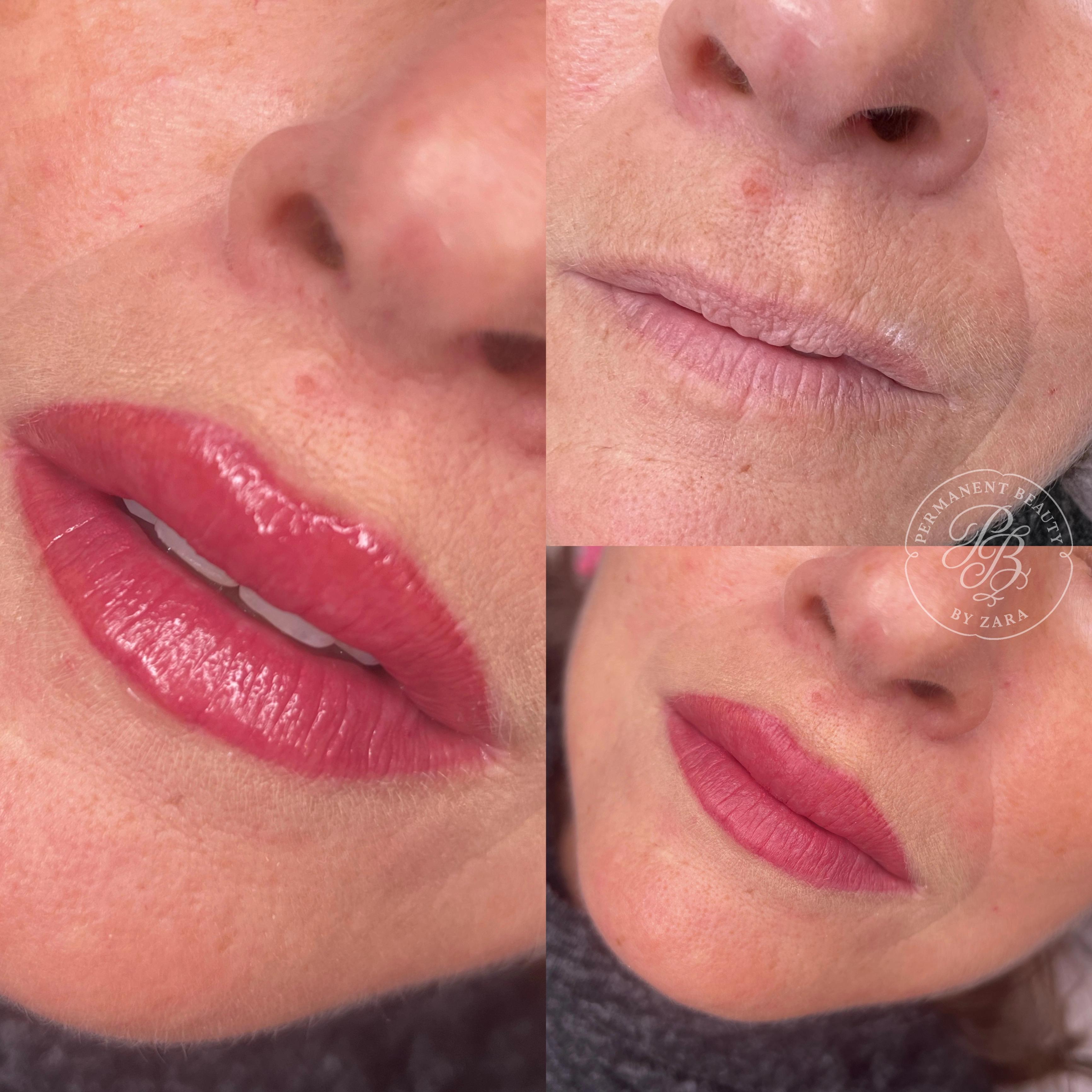 Lippenpigmentierung Vorher-Nachher bei reifer Frau